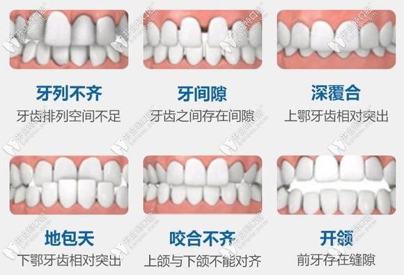 北京瑞泰齒科正畸醫(yī)生