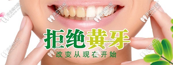 沈陽米蘭口腔做6顆超薄瓷貼面僅要9800元起