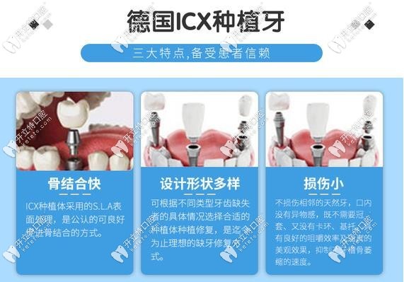 新橋口腔德國icx進(jìn)口種植牙的費(fèi)用