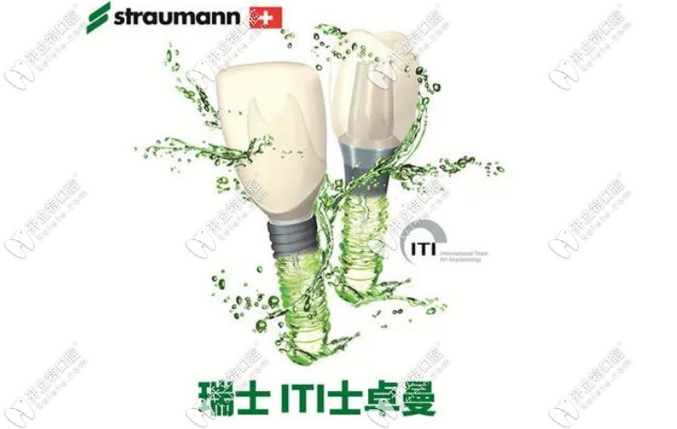 瑞士ITI種植體的價(jià)格