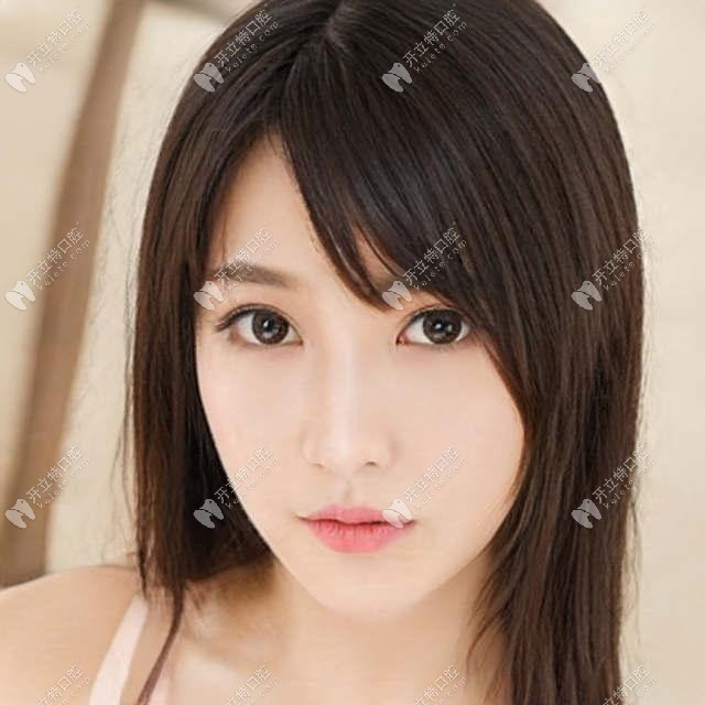 2月西安未央和曲江連鎖牙科韓國(guó)進(jìn)口種植牙包干價(jià)格2800起