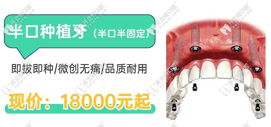 藍(lán)天口腔做半口種植牙價(jià)格