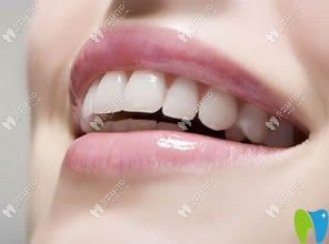 牙齒缺損修復(fù)哪種效果比較好