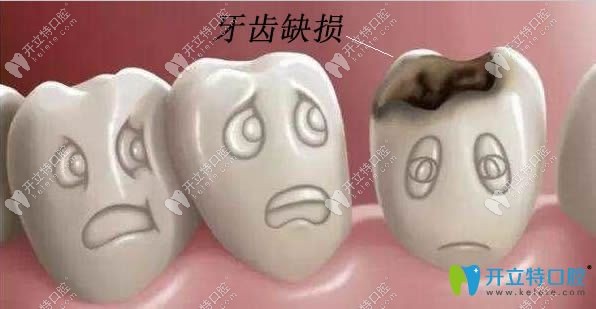 牙齒缺損的修復(fù)方法有哪些