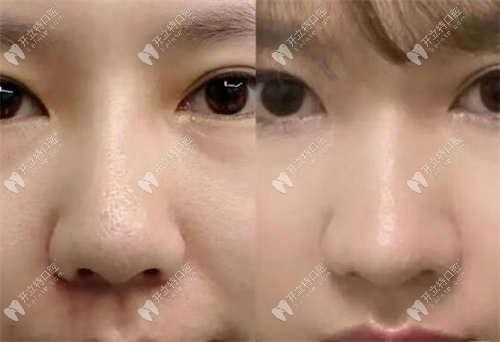 來聊聊成都簇橋亞泰口腔矯正牙齒的收費高嗎？
