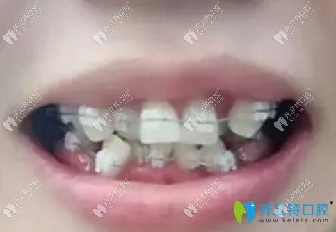 珠海九龍口腔醫(yī)院牙齒矯正怎么樣