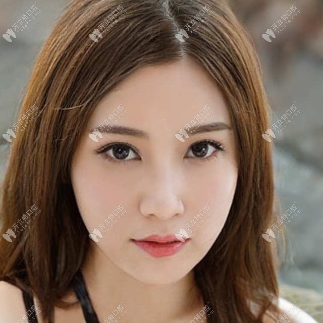 誰知道鄭州植得口腔做牙齒矯正怎么樣?哪位正畸醫(yī)生技術(shù)好