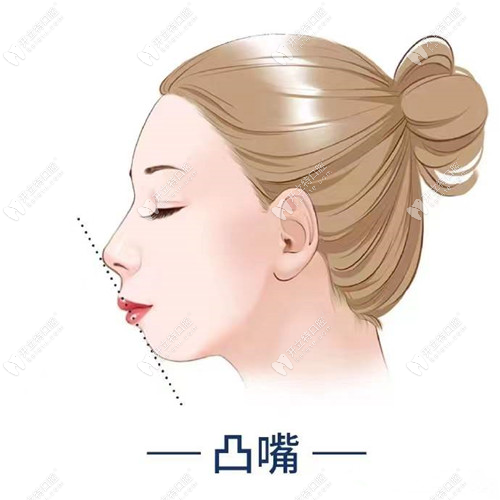 寧德牙齒矯正多少錢(qián)