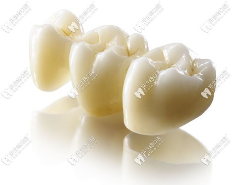 500元的全瓷牙質(zhì)量介紹