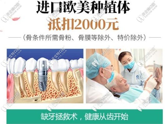 廣州圣貝口腔預存28.8元種植體抵扣2千元