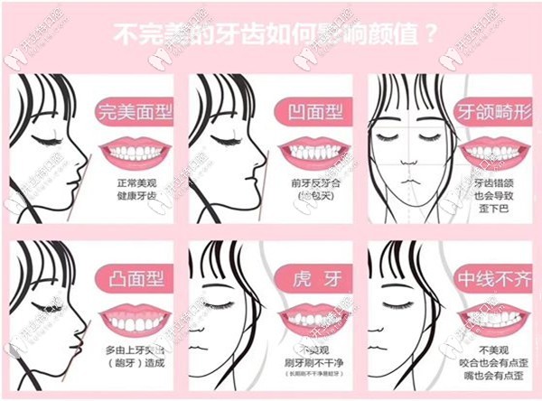 青少年牙齒畸形的危害