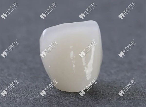 全瓷牙外觀展示圖kelete.com
