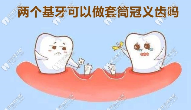 兩個基牙可以做套筒冠義齒嗎