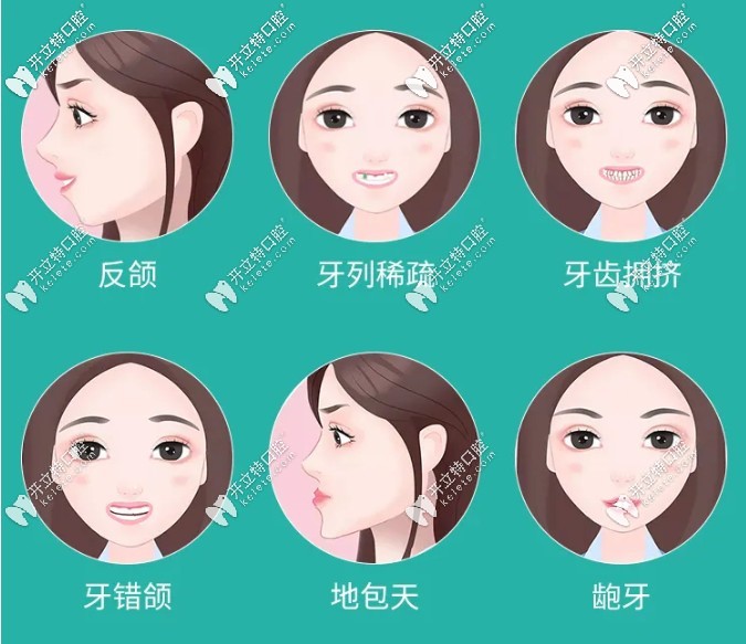 牙齒不齊的類型