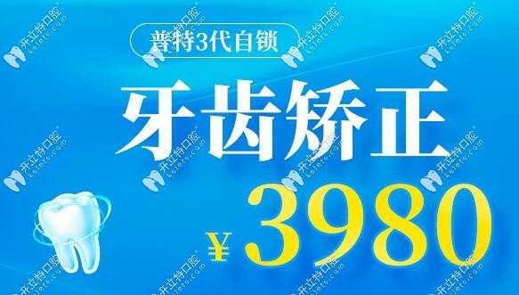 金属牙套活动价格是3980元起