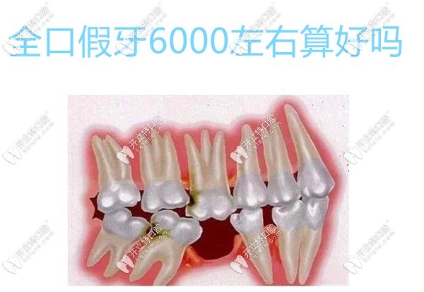 全口假牙6000左右算好嗎？