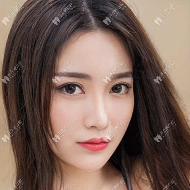 深圳南山區(qū)美奧口腔暑期無托槽隱形矯正才16800元哦