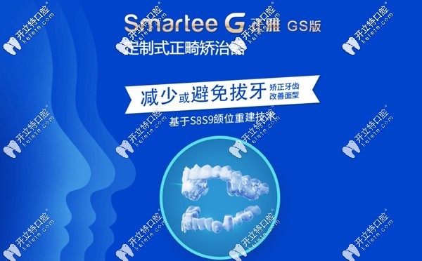 smartee正雅GS版牙套