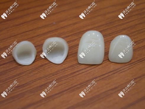 全瓷牙全方位立体展示图