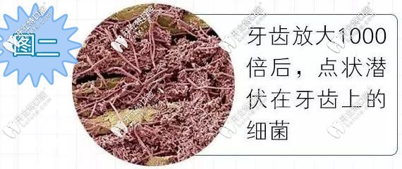 牙齿放大1千倍上面的细菌