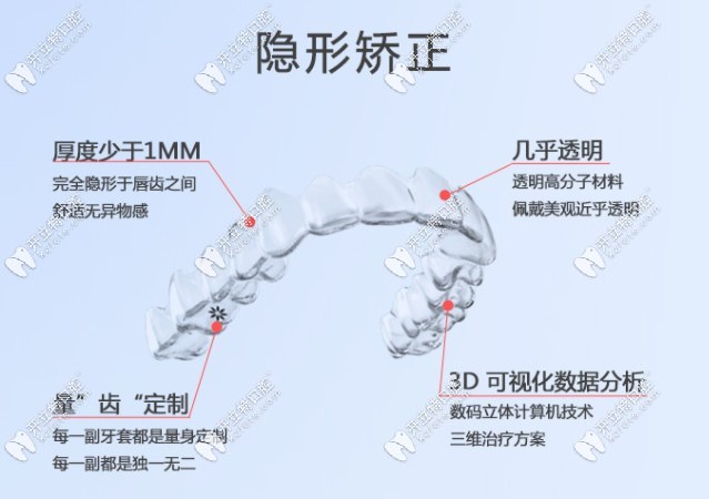 隐形牙齿矫正的优点了解下