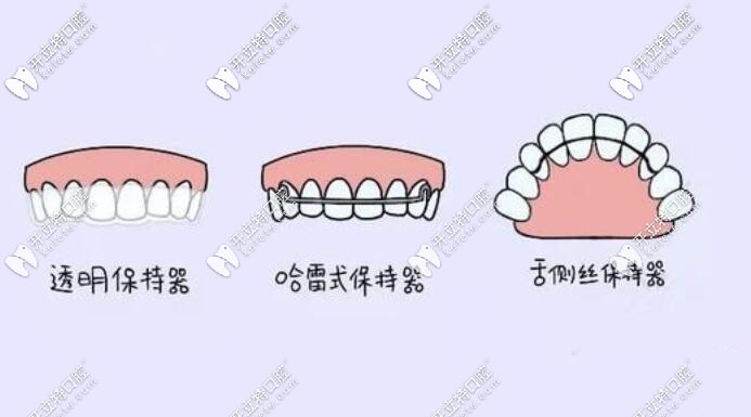 各种牙齿矫正器