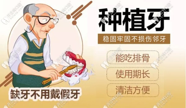 種植牙的優(yōu)勢(shì)kelete.com