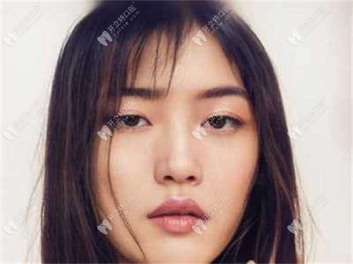 西安舌側(cè)矯正做得好的地方?美奧/團圓口腔皆有技術(shù)好的醫(yī)生