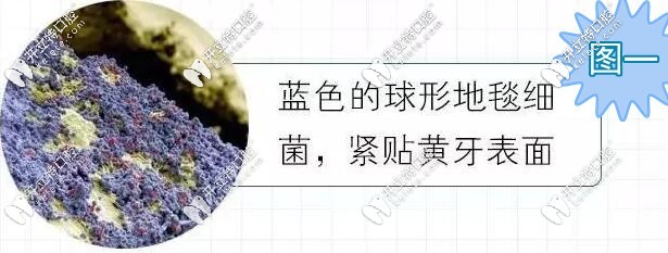 显微镜下的牙齿表面