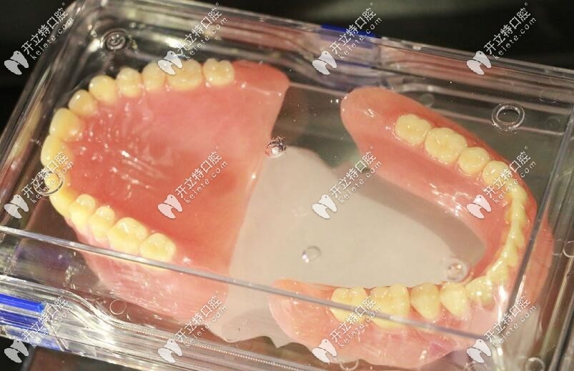 問爆的長沙全口活動義齒種類及價格來了