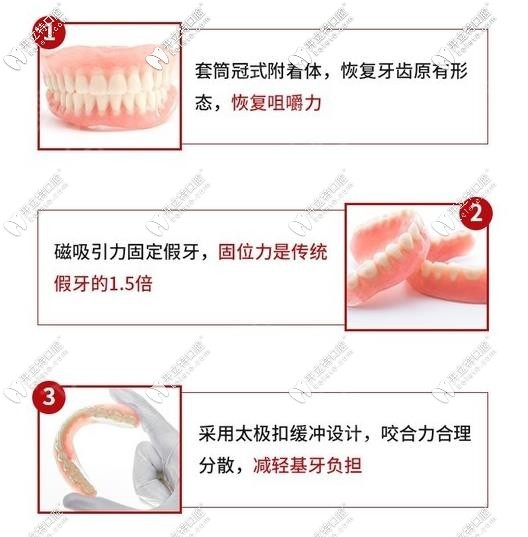 全口可吸附性義齒的優(yōu)勢
