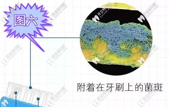 附在牙刷上的细菌