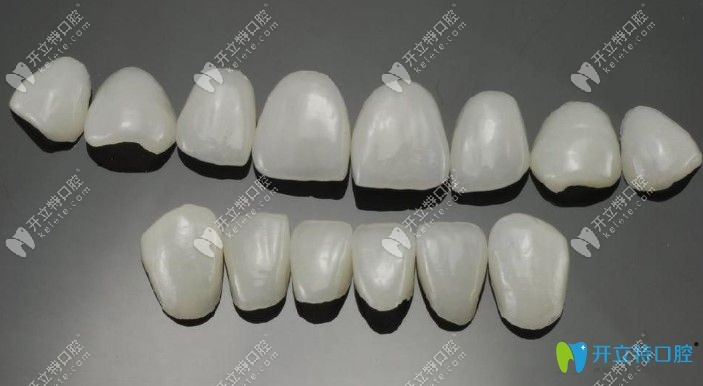 全瓷牙贴面1800元贵不贵