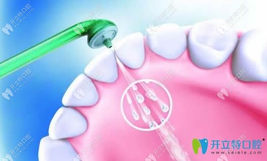 不適合洗牙的5類(lèi)人群
