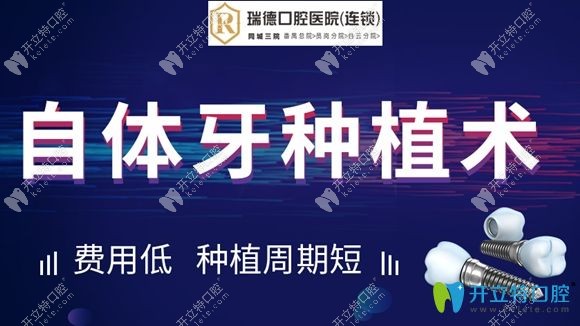 廣州瑞德口腔可開展自體牙移植術(shù)
