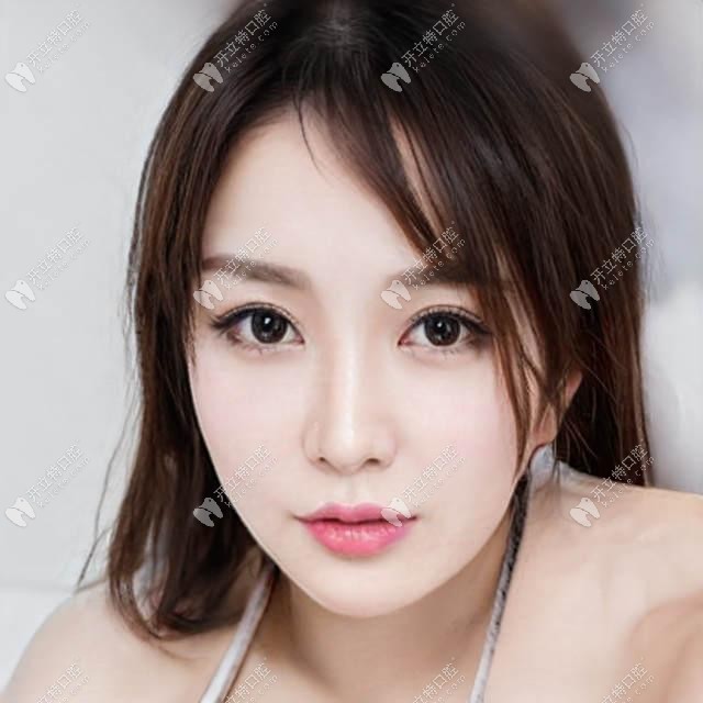 時代天使comfos能解決深覆合嗎?介紹comfos適合矯正什么樣的牙