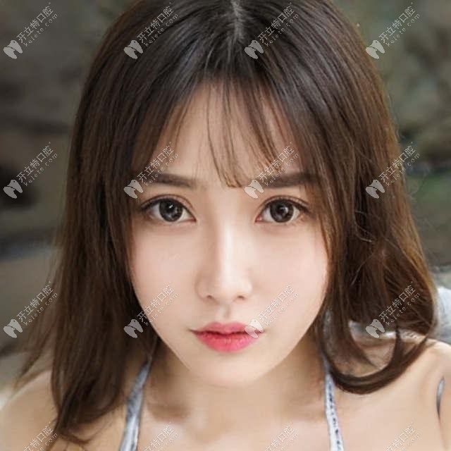 貼面?zhèn)溲婪譃閹追N類型?這3種對接方式示意圖奉上
