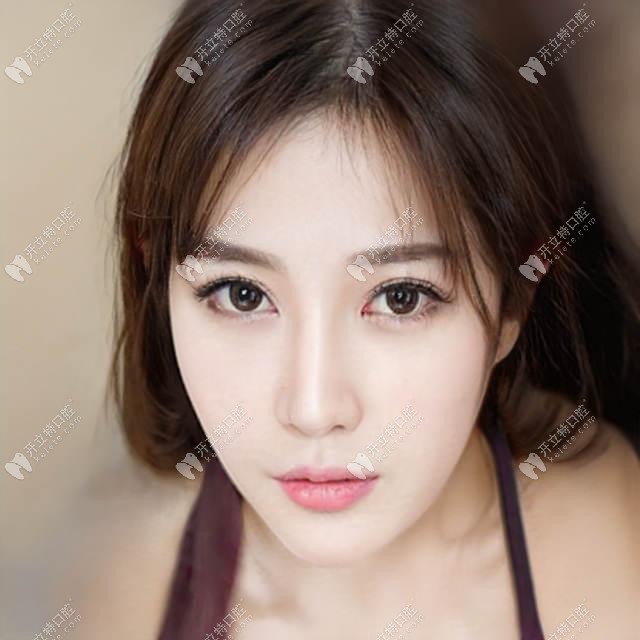 镶牙能不能不磨邻牙?不用磨两边牙的隐形镶牙了解一下