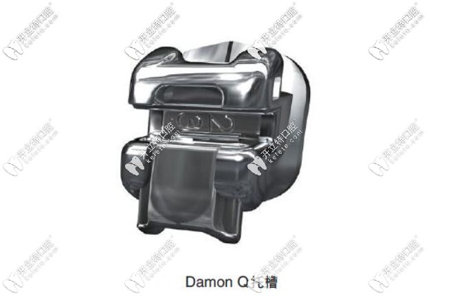 美國damon自鎖牙套的價格