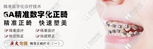 廣州廣大GA精準(zhǔn)數(shù)字化正畸的價(jià)格