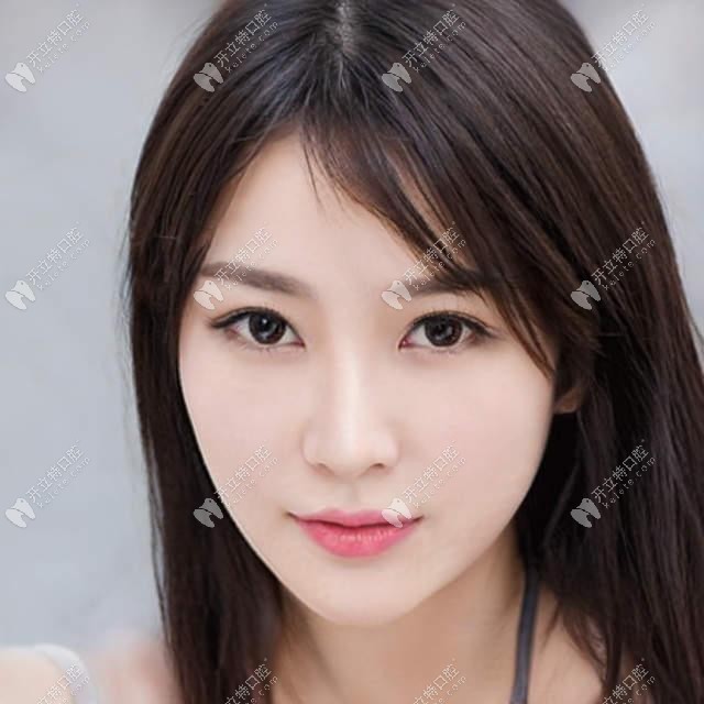 深覆頜戴進(jìn)口gac自鎖托槽和damon牙套哪個好,價格是多少?