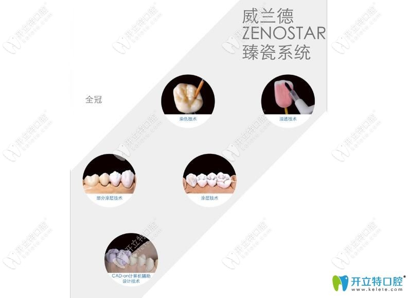 威兰德臻瓷系统图片