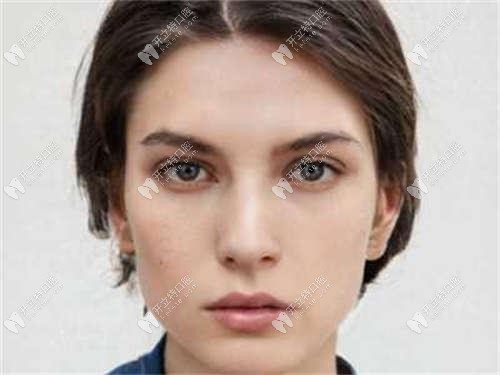 两个大门牙往外翘怎么办?如果只想矫正2颗门牙可以吗