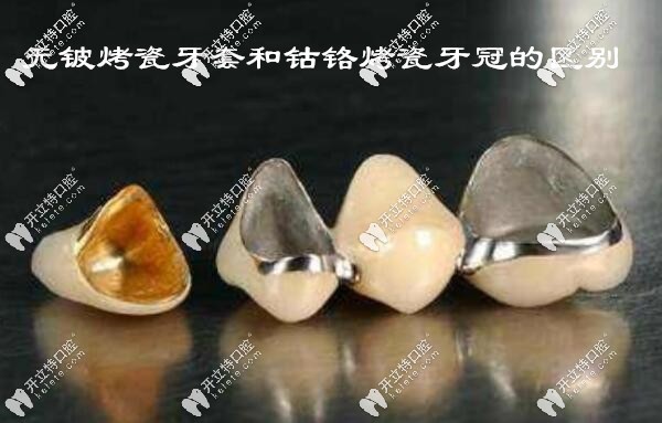 无铍烤瓷牙套和钴铬烤瓷牙冠的区别