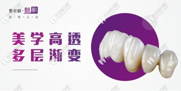 魅影全瓷冠優(yōu)勢點