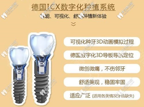 我做全口種植牙用了8顆ICX種植體