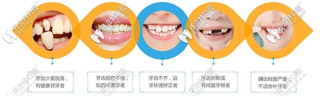 各種適合做修復(fù)的人群