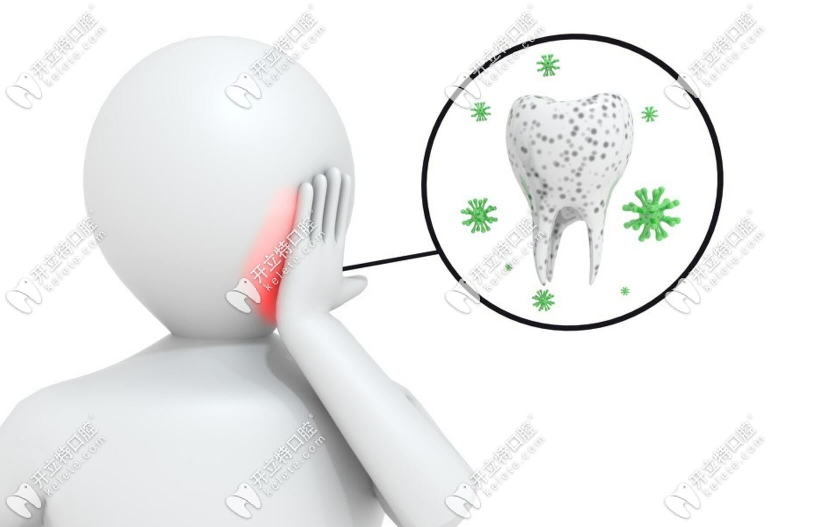牙周炎可以做種植牙