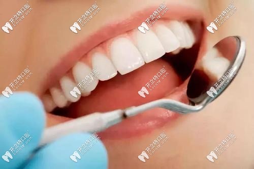 重慶美奧口腔做一顆牙貼面的價(jià)格