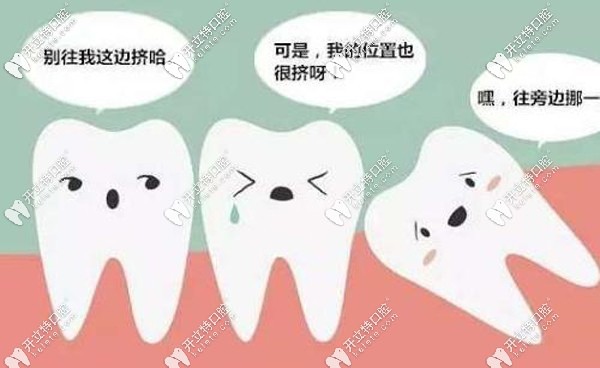 智齒生長時會擠迫鄰牙